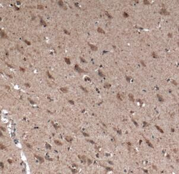 MCHR1 Rabbit Polyclonal Antibody