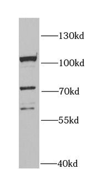 MCM4 Rabbit Polyclonal Antibody