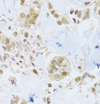 MCM4 Rabbit Polyclonal Antibody