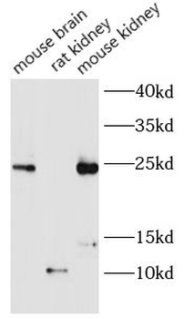 CCL2 Rabbit Polyclonal Antibody