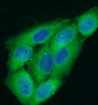 CCL2 Rabbit Polyclonal Antibody