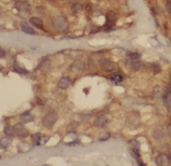 CCL2 Rabbit Polyclonal Antibody