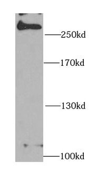 MDC1 Rabbit Polyclonal Antibody