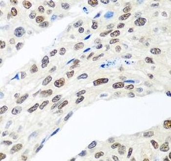MDC1 Rabbit Polyclonal Antibody