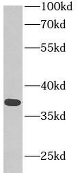 MDH1 Rabbit Polyclonal Antibody