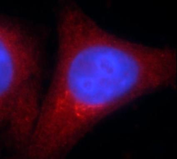 MDH1 Rabbit Polyclonal Antibody