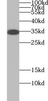 MDH2 Rabbit Polyclonal Antibody