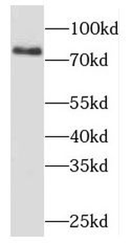 MDM1 Rabbit Polyclonal Antibody