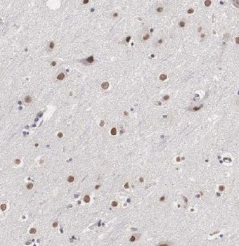 MDM1 Rabbit Polyclonal Antibody