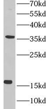 MED10 Rabbit Polyclonal Antibody