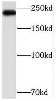 MED12 Rabbit Polyclonal Antibody