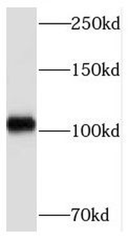 MED15 Rabbit Polyclonal Antibody