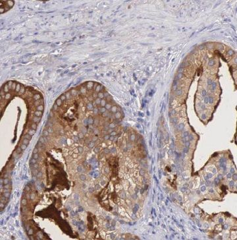 MED15 Rabbit Polyclonal Antibody