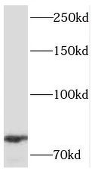 MED17 Rabbit Polyclonal Antibody