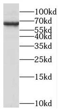 MED26 Rabbit Polyclonal Antibody
