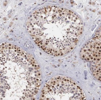 MED28 Rabbit Polyclonal Antibody