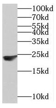 MED30 Rabbit Polyclonal Antibody