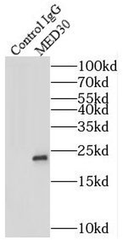 MED30 Rabbit Polyclonal Antibody