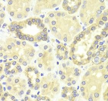 MAP2K2 Rabbit Polyclonal Antibody