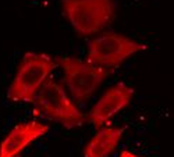 MAP2K5 Rabbit Polyclonal Antibody