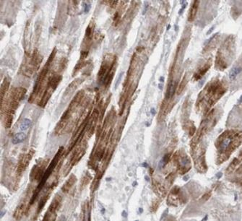 MAP2K5 Rabbit Polyclonal Antibody