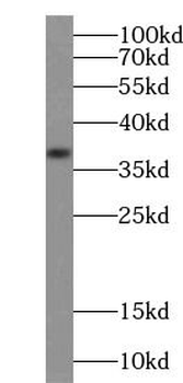 MAP2K6 Rabbit Polyclonal Antibody