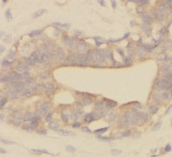 MAP2K6 Rabbit Polyclonal Antibody