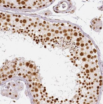 METAP2 Rabbit Polyclonal Antibody