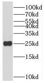 NTMT1 Rabbit Polyclonal Antibody