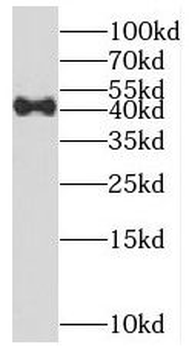METTL9 Rabbit Polyclonal Antibody