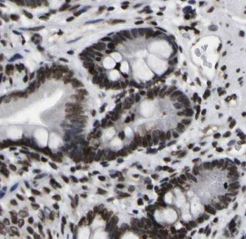 METTL9 Rabbit Polyclonal Antibody