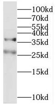 MFF Rabbit Polyclonal Antibody