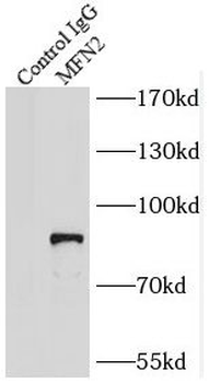 MFN2 Rabbit Polyclonal Antibody