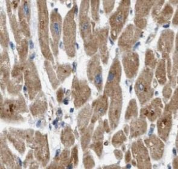 MFN2 Rabbit Polyclonal Antibody
