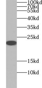 MGMT Rabbit Polyclonal Antibody