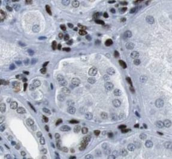 MGMT Rabbit Polyclonal Antibody