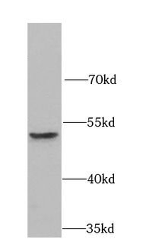 MICA Rabbit Polyclonal Antibody