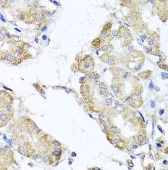 MICA Rabbit Polyclonal Antibody