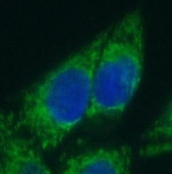 MICAL1 Rabbit Polyclonal Antibody
