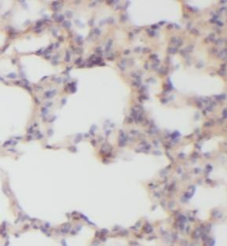 MICAL1 Rabbit Polyclonal Antibody