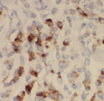 MICAL2 Rabbit Polyclonal Antibody