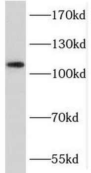 MICALL2 Rabbit Polyclonal Antibody