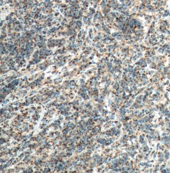 CCL19 Rabbit Polyclonal Antibody