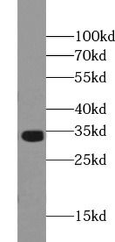 NIFK Rabbit Polyclonal Antibody