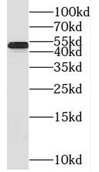 STARD3 Rabbit Polyclonal Antibody