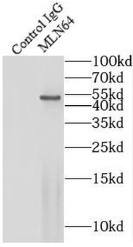 STARD3 Rabbit Polyclonal Antibody