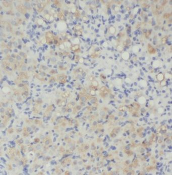STARD3 Rabbit Polyclonal Antibody