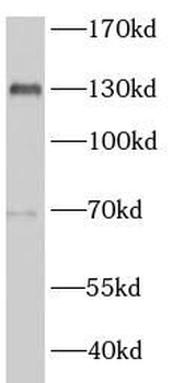 MLXIP Rabbit Polyclonal Antibody