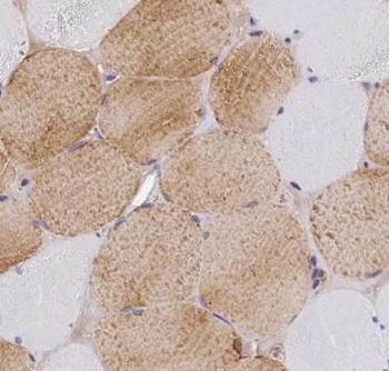 MLXIP Rabbit Polyclonal Antibody