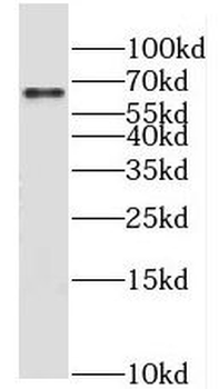 MLXIPL Rabbit Polyclonal Antibody